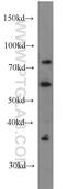 LIM Domain Kinase 1 antibody, 19699-1-AP, Proteintech Group, Western Blot image 