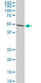 Inosine Monophosphate Dehydrogenase 1 antibody, LS-C197532, Lifespan Biosciences, Western Blot image 