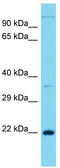 Cancer/Testis Antigen Family 45 Member A1 antibody, TA332257, Origene, Western Blot image 