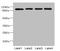 Ubiquitin Specific Peptidase 26 antibody, LS-C676692, Lifespan Biosciences, Western Blot image 
