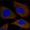 SPC25 Component Of NDC80 Kinetochore Complex antibody, HPA047144, Atlas Antibodies, Immunofluorescence image 