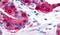 Transient Receptor Potential Cation Channel Subfamily M Member 8 antibody, PA5-34286, Invitrogen Antibodies, Immunohistochemistry frozen image 