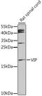 Vasoactive Intestinal Peptide antibody, LS-C747626, Lifespan Biosciences, Western Blot image 