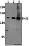 Tensin-3 antibody, A07345, Boster Biological Technology, Western Blot image 