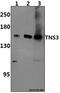 Tensin 3 antibody, A07345, Boster Biological Technology, Western Blot image 