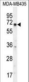 Potassium Voltage-Gated Channel Subfamily Q Member 1 antibody, LS-C165445, Lifespan Biosciences, Western Blot image 