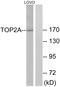 DNA Topoisomerase II Alpha antibody, LS-C117993, Lifespan Biosciences, Western Blot image 