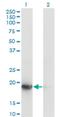 Ubiquitin Conjugating Enzyme E2 G1 antibody, H00007326-M01, Novus Biologicals, Western Blot image 