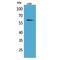 Interleukin 2 Receptor Subunit Beta antibody, LS-C387042, Lifespan Biosciences, Western Blot image 