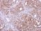 PAS Domain Containing Serine/Threonine Kinase antibody, NBP2-19704, Novus Biologicals, Immunohistochemistry frozen image 