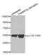 LCK Proto-Oncogene, Src Family Tyrosine Kinase antibody, abx000234, Abbexa, Western Blot image 