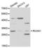 Regulator Of Calcineurin 1 antibody, abx004072, Abbexa, Western Blot image 