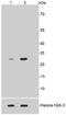 Histone Cluster 1 H1 Family Member E antibody, NBP2-67313, Novus Biologicals, Western Blot image 