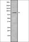 ADAM Metallopeptidase Domain 33 antibody, orb337962, Biorbyt, Western Blot image 