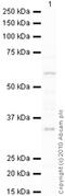 Cytochrome P450 Family 19 Subfamily A Member 1 antibody, ab18995, Abcam, Western Blot image 