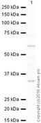 Cytochrome P450 19A1 antibody, ab18995, Abcam, Western Blot image 