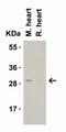 C1q And TNF Related 3 antibody, NBP1-76628, Novus Biologicals, Western Blot image 