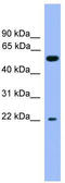 Cochlin antibody, TA342661, Origene, Western Blot image 