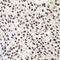 Negative Elongation Factor Complex Member E antibody, LS-C746830, Lifespan Biosciences, Immunohistochemistry frozen image 