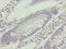 Vacuolar Protein Sorting 25 Homolog antibody, CSB-PA887108LA01HU, Cusabio, Immunohistochemistry frozen image 