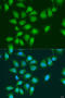 EYA Transcriptional Coactivator And Phosphatase 3 antibody, A15056, ABclonal Technology, Western Blot image 