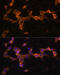 Platelet Derived Growth Factor Receptor Beta antibody, 18-555, ProSci, Immunofluorescence image 