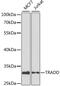 TNFRSF1A Associated Via Death Domain antibody, MBS126575, MyBioSource, Western Blot image 