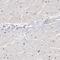 Forkhead Box P2 antibody, NBP1-86672, Novus Biologicals, Immunohistochemistry paraffin image 