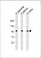 Mucin-9 antibody, M07911, Boster Biological Technology, Western Blot image 