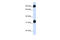 Heat Shock Protein Family A (Hsp70) Member 4 antibody, 26-101, ProSci, Enzyme Linked Immunosorbent Assay image 