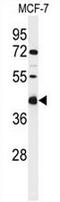 Transmembrane Protein 268 antibody, AP50920PU-N, Origene, Western Blot image 