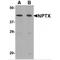 Neuronal Pentraxin 2 antibody, TA306565, Origene, Western Blot image 