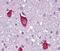 Parathyroid Hormone 2 Receptor antibody, GTX70617, GeneTex, Immunohistochemistry paraffin image 