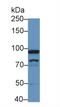 Ribonucleotide Reductase Catalytic Subunit M1 antibody, abx129199, Abbexa, Western Blot image 