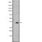 Testis Specific Serine Kinase 3 antibody, abx147614, Abbexa, Western Blot image 