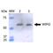 WD repeat domain phosphoinositide-interacting protein 2 antibody, LS-C773933, Lifespan Biosciences, Western Blot image 