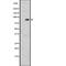 Ribosomal Protein S6 Kinase A1 antibody, abx217750, Abbexa, Western Blot image 