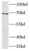 Telomeric Repeat Binding Factor 2 antibody, FNab08598, FineTest, Western Blot image 