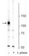 Polo Like Kinase 1 antibody, P00182-1, Boster Biological Technology, Western Blot image 