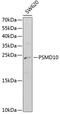 Proteasome 26S Subunit, Non-ATPase 10 antibody, GTX32820, GeneTex, Western Blot image 