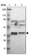 Ankyrin Repeat And SOCS Box Containing 8 antibody, NBP1-83620, Novus Biologicals, Western Blot image 