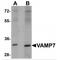Vesicle Associated Membrane Protein 7 antibody, MBS150467, MyBioSource, Western Blot image 