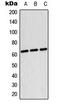 Testis Associated Actin Remodelling Kinase 2 antibody, LS-B13648, Lifespan Biosciences, Western Blot image 