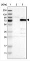 Vezatin, Adherens Junctions Transmembrane Protein antibody, NBP1-85039, Novus Biologicals, Western Blot image 