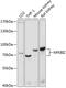 NFKB Inhibitor Zeta antibody, 13-686, ProSci, Western Blot image 