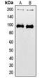 Insulin Like Growth Factor 1 Receptor antibody, LS-C352358, Lifespan Biosciences, Western Blot image 