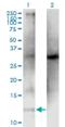 Colipase antibody, H00001208-M05, Novus Biologicals, Western Blot image 