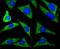 Solute Carrier Family 39 Member 12 antibody, NBP2-75665, Novus Biologicals, Immunocytochemistry image 