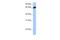 Mitotic Spindle Positioning antibody, A08017, Boster Biological Technology, Western Blot image 