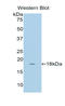 Cytochrome P450 Family 1 Subfamily B Member 1 antibody, LS-C299599, Lifespan Biosciences, Western Blot image 